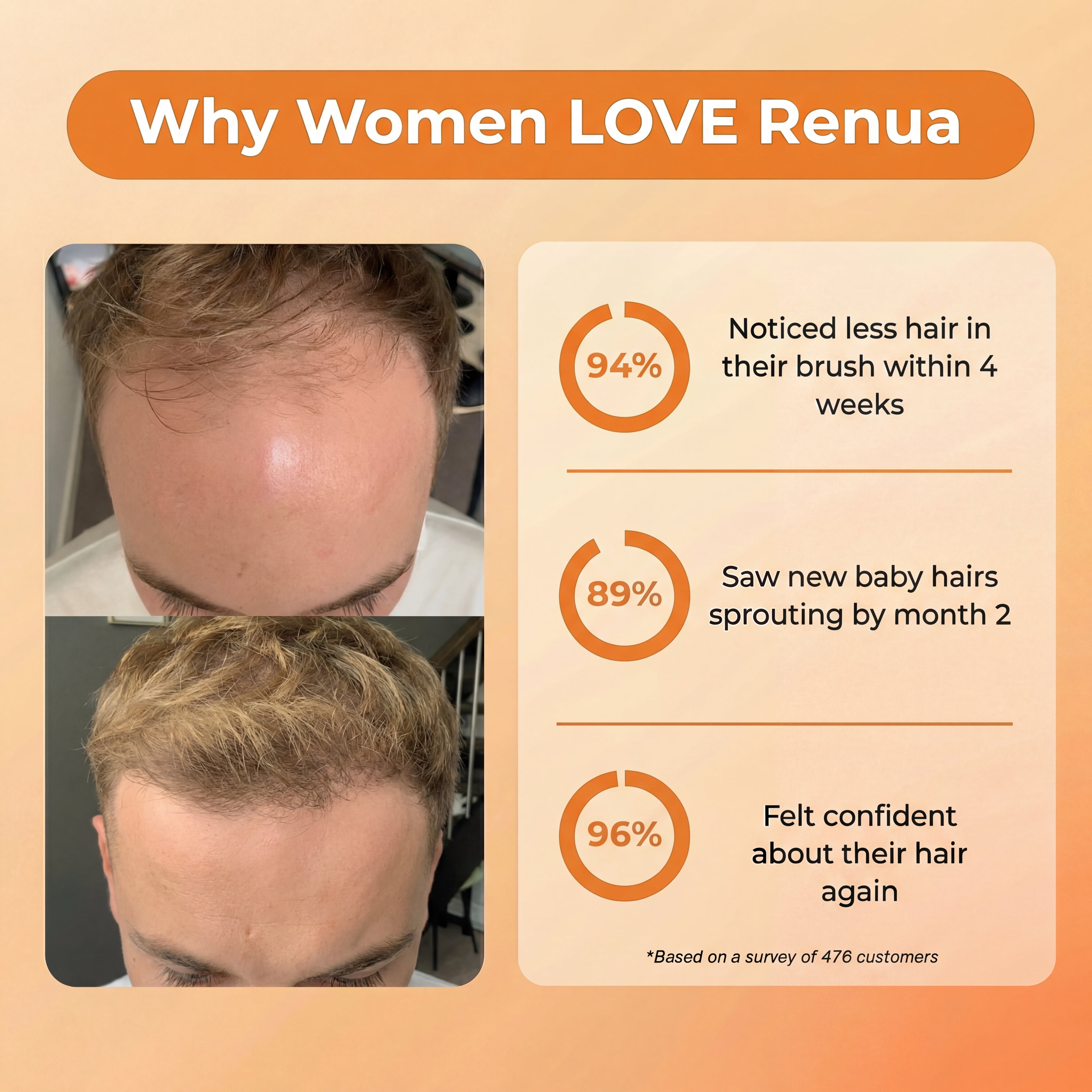 Pumpkin Seed Oil with Saw Palmetto